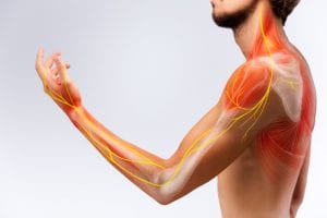 Ask the Chiropractor: Do I Have a Pinched Nerve?