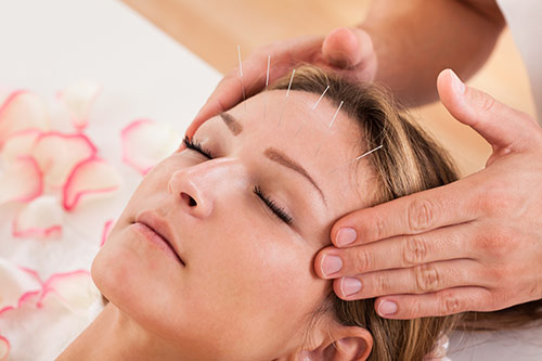 How Acupuncture Works? 